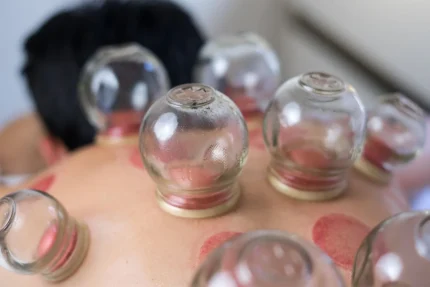 Curso Masajes con Ventosa